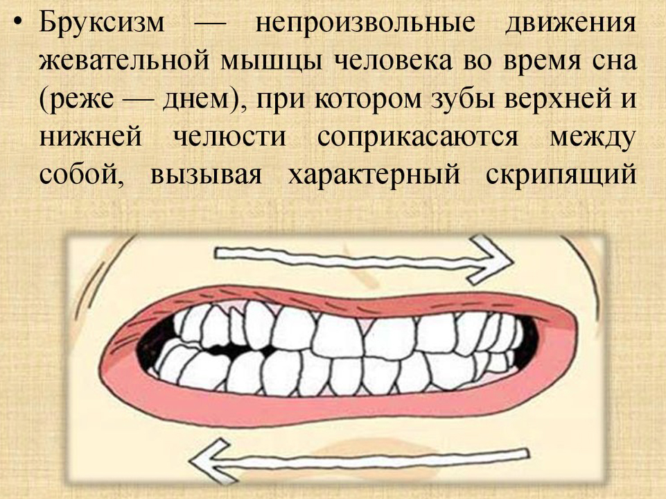 Бруксизм или почему ребенок скрипит зубами?