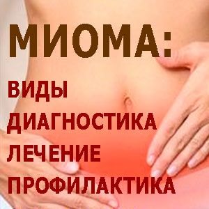 миома матки диагностика