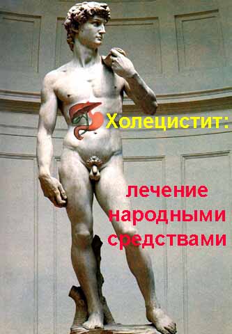 Холецистит Воспаление желчного пузыря