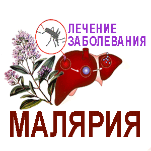 Малярия-лихорадка лечение малярии
