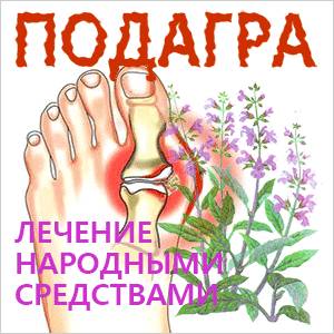 подагра-лечение