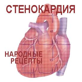 стенокардия Сердце и кардиограмма