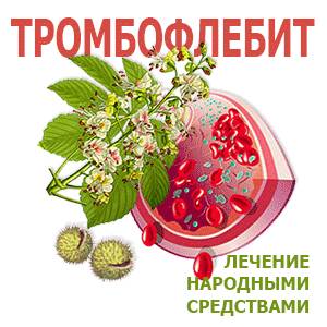 Тромбофлебит Конский каштан от тромбофлебита