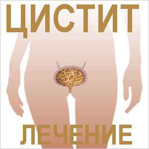 Цистит Как лечить цистит