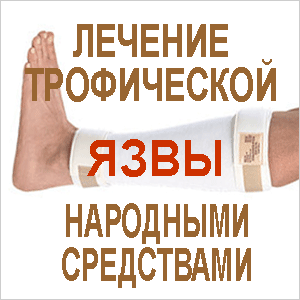 Язва лечение трофической язвы